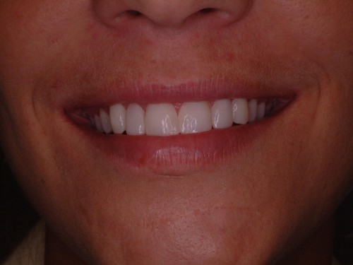 tellman dentistrey Marty Before