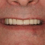 lous dental work tellman dentistry